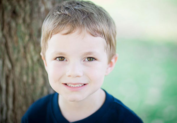 Fluoride and Decay Prevention